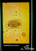 4.3.001 Huevecillo de Haemonchus contortus visto al microscopio_1