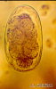 4.3.003 Huevecillo de Buonostomun spp. visto microscópicamente_1