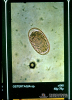 4.3.005 Huevecillo de Ostertagia spp. visto al microscopio_1