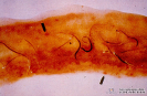  4.3.006 Ancylostoma caninum en el intestino delgado de un canideo_1