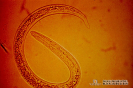 4.6.001 Vista microscópica de la larva de Dyctiocaulus spp. (Observar el botón cefálico)_1