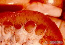 1.3.060	Petequias y equimosis en la corteza renal de un caso de fiebre porcina clásica_1