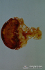 1.3.085	Hemorragia capsular de un nódulo linfático_1