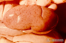 1.3.093	Innumerables petequias en el riñón de cerdo que le confieren el aspecto de un huevo de guajolote_1