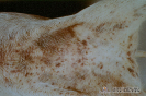 1.3.096	Hemorragias en la piel de la región ventral_1