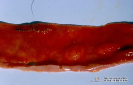 Pequeños focos de necrosis en el intestino de un perro_1