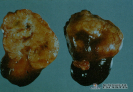  1.2.010 Linfoma renal (canideo)_1