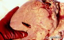  1.2.021 Linfosarcoma viral bovino con metástasis en el corazón_1