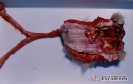 2.11.026 Linfogranuloma transmisible que presenta áreas de hemorragia(perra)_1