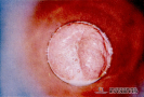 2.11.035 Exploración clínica de una cervicitis supurativa (cerda)_1