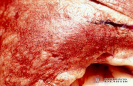  2.6.003 Antracosis en donde se aprecia a mayor detalle las zonas con enfisema pulmonar (canideo)_1