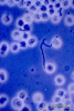 2.9.003 Microscopia de sedimento urinario. Cadenas de bacilos y numerosos leucocitos_1