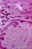 2.9.009 Microfotografía de un túbulo renal dilatado de un riñón de perro_1