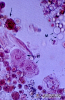 2.9.012Células de epitelio renal nucleadas (n) rodeadas por eritrocitos, leucocitos con y sin tinción (w) y células de origen incierto (flechas)_1