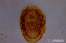 2.9.018 Huevecillo del parasito dictiophyma renales (Sedimento urinario de perro)_1