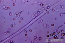 2.9.019 Microfilaria de dirofilaria immitis en el sedimento urinario de perro, rodeada por eritrocitos, leucocitos, espermatozoides y células epiteliales_1