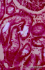 2.9.024 Microfotografía de cristales de oxalato inducidos por etilen-glicol en los túbulos renales de un perro_1