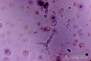   2.9.013 Levaduras en el sedimento urinario de un gato, rodeadas por eritrocitos con presencia ocasional de leucocitos_1