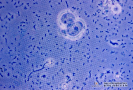  2.9.014 Numerosas bacterias y algunas células de epitelio renal. Microscopia de contaste de fase_1