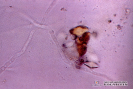  2.9.016 Hifa micotica y cristales no identificados en el sedimento urinario de canino_1