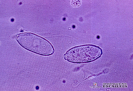  2.9.036 Artefactos y contaminantes en el sedimento urinario. Granos de polen y espermatozoides_1