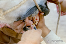 2.1009 Vista lateral del caso de haba en equino (el tejido hiperplasico tiene la misma longitud de los incisivos del maxilar superior)_1