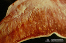 2.1.045 Actinobacilosis bovina (corte longitudinal de la musculatura de la lengua con lesiones causadas por colonias de actinobacillus lignieresi)_1