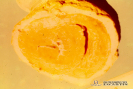 2.2.016 Reticulopericarditis traumática (el pericardio hiperplásico está muy adherido al epicardio)_1