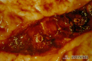 2.2.031 Bis Reticuloperitonitis traumática con hemorragia aguda y mortal para la vaca (observar a detalle la lesión de una arteria de mediano calibre y la zona de hemorragia)_1