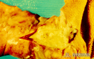  2.2.015 Reticuloperitonitis traumática en la que se produjo inflamación supurativa o purulenta en cavidad peritoneal_1