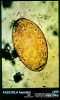 2.4.033 Huevo de color amarillo-dorado característico de fasciola hepática (Visto al microscopio)_1