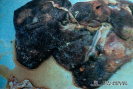 2.4.042 Hígado y sus conductos con hiperplasia de tejido conectivo a causa de la fasciola hepática_1