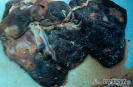   2.4.020 Hepatitis con fibrosis de los conductos hepáticos a causa de la infestación de fasciola hepática_1