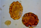 2.5.015 Vista microscópica de huevos de ascarys suum parásito intestinal del cerdo_1