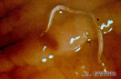   2.5.002 Estado adulto del nematodo bunostomun en el intestino de un ovino_1