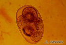  2.5.018 Vista microscópica de un huevo blastomerado de strongylus spp_1