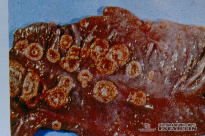  1.6.020	Ulceras botonosas con necrosis de intestino de un porcino_1