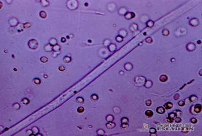 2.9.019 Microfilaria de dirofilaria immitis en el sedimento urinario de perro, rodeada por eritrocitos, leucocitos, espermatozoides y células epiteliales_1