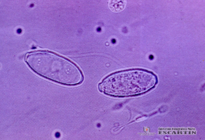  2.9.036 Artefactos y contaminantes en el sedimento urinario. Granos de polen y espermatozoides_1