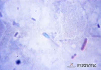 2.12.011 Bacterias del genero clostridium spp causantes de la mastitis gangrenosa_1